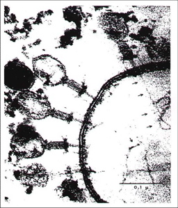 Phages attacking listeria bacterium